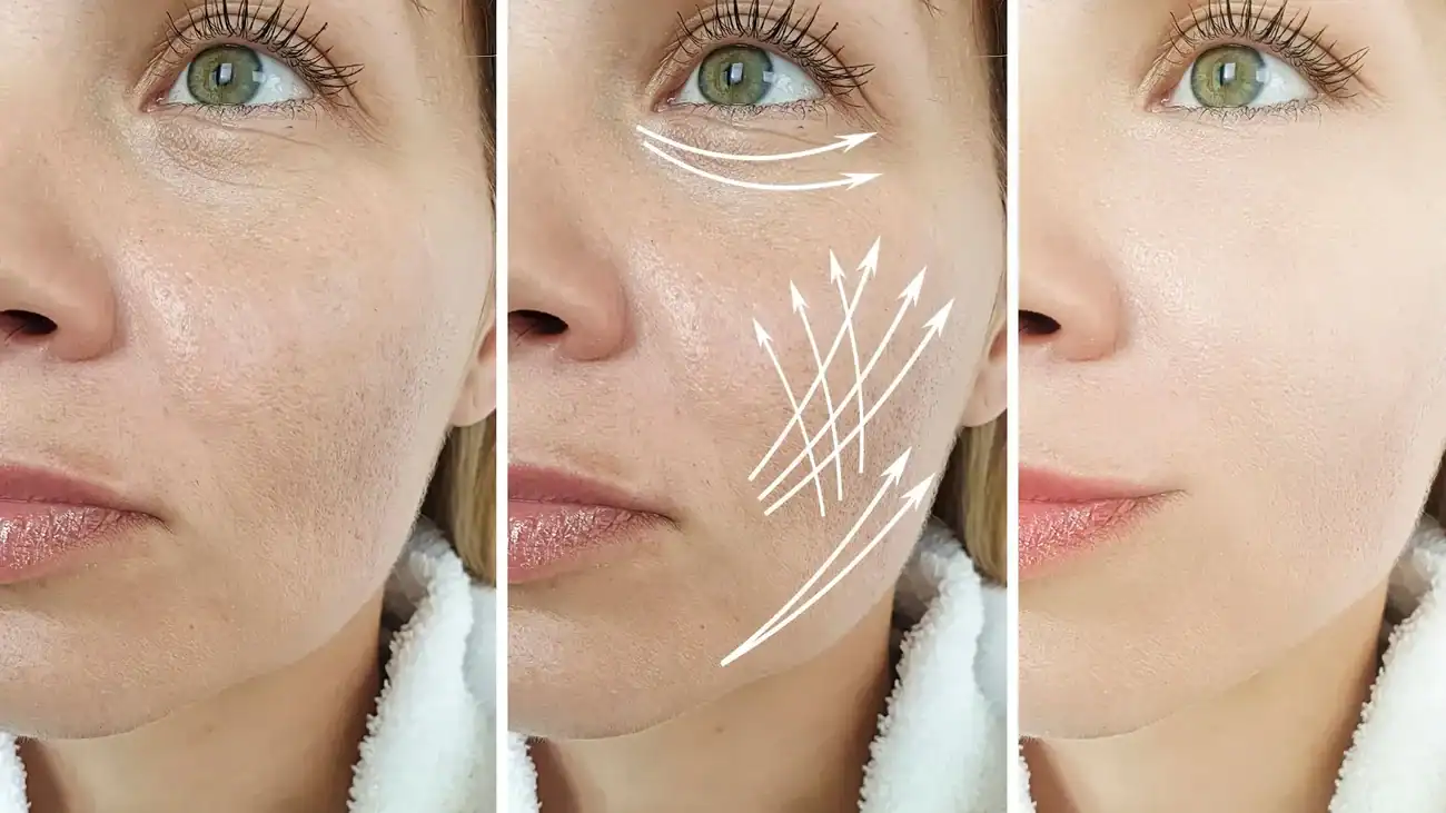 Can One Treatment Really Tackle More Than One Skin Concern Shepperton Green?