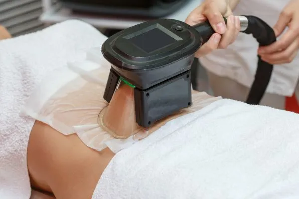 Image of person having fat freezing treatment to help weight gain Shepperton Green