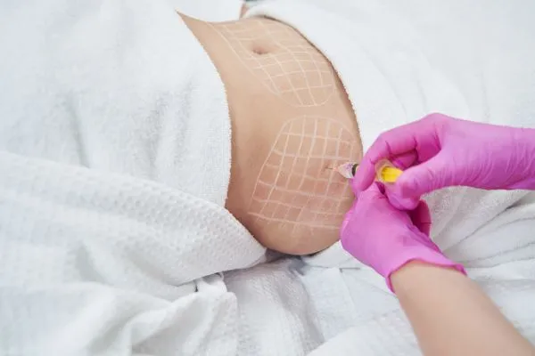 image of fat dissolving injections on love handles to help combat weight gain Shepperton Green