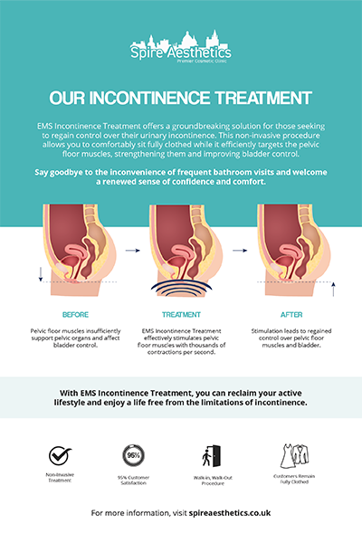 image to show how EMS treatment works for female urinary incontinence Shepperton Green