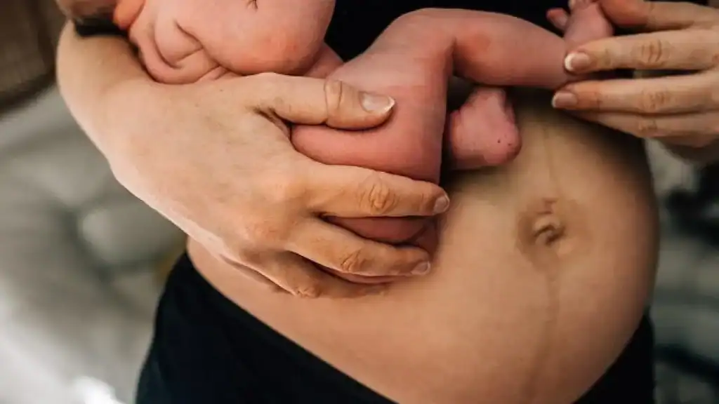 Why Is My Stomach Still Big After Pregnancy Shepperton Green?